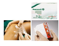MEDICAZIONE STERILE IN FILM IN POLIURETANO TRASP. SUPRASORB F 10X12CM 10 PEZZI - latuafarmacia.org