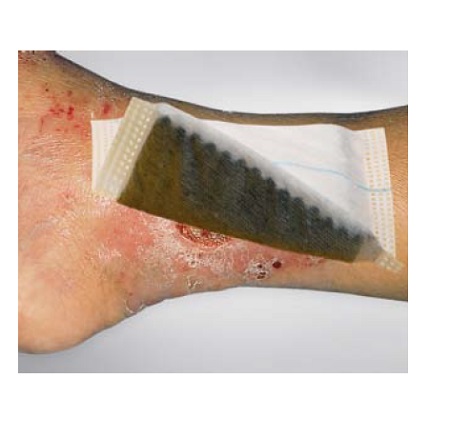 MEDICAZIONE IN TESSUTO NON TESSUTO AL CARBONE ATTIVO E ARGENTO COMPRESSA ASSORBENTE 10X10CM 10 PEZZI - latuafarmacia.org